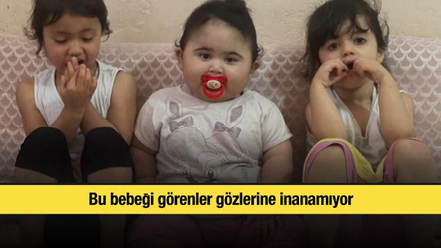 Bu bebeği görenler gözlerine inanamıyor